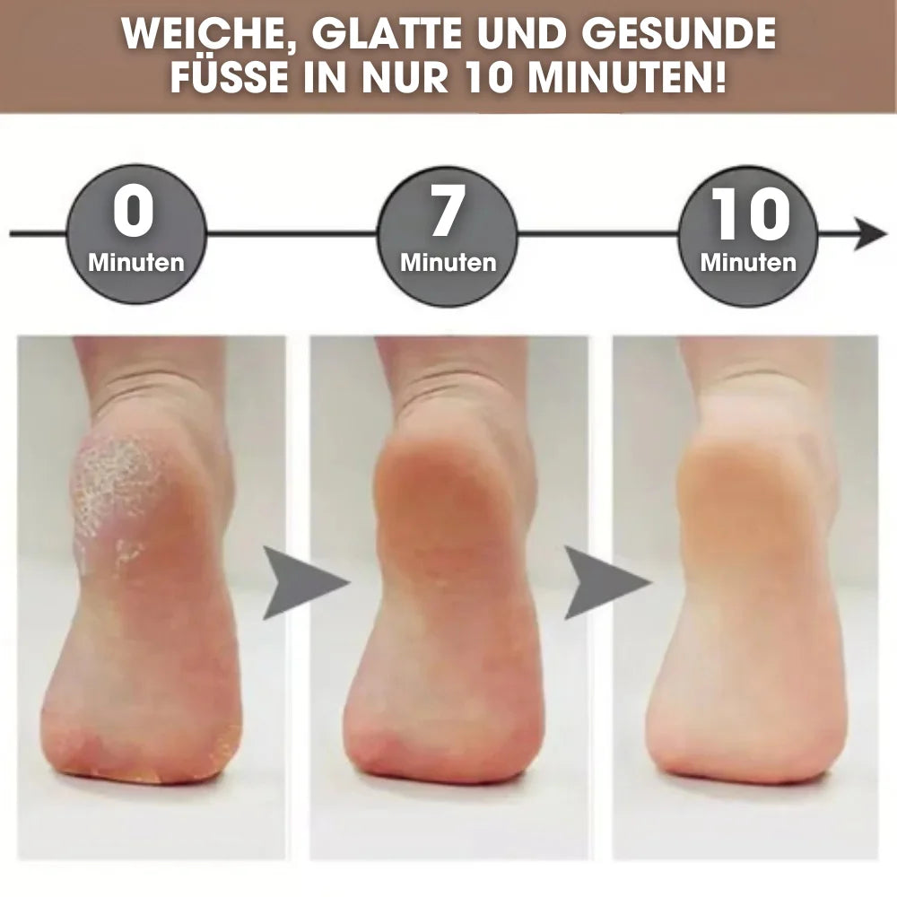 CalluCare™ – Elektrischer Hornhautentferner