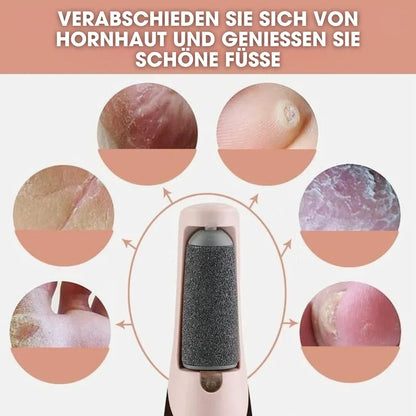 CalluCare™ – Elektrischer Hornhautentferner